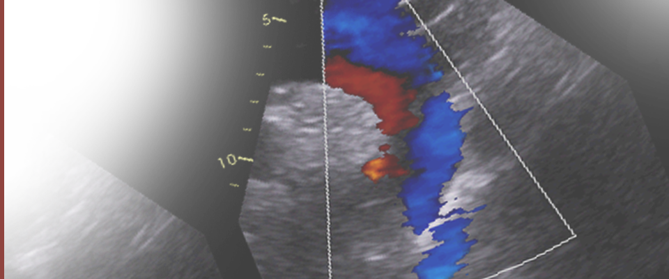 Echocardiography Data Set