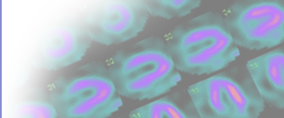 Nuclear Cardiology Data Set